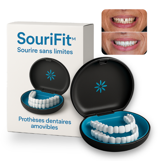 Sourifit™  - Facettes modulables